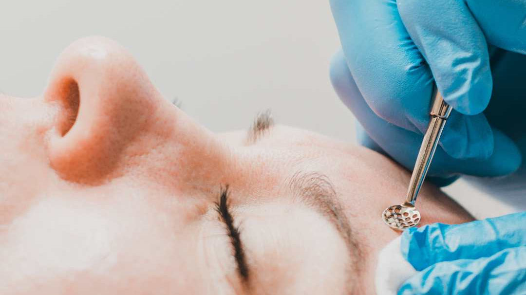 Waarom krijg je puistjes? De meest voorkomende oorzaken van een onzuivere huid