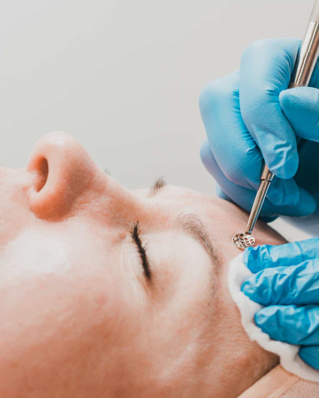 Waarom krijg je puistjes? De meest voorkomende oorzaken van een onzuivere huid